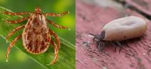 Rocky Mountain Spotted Fever Is the Deadly Tick-Borne Disease on the Rise